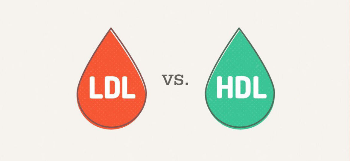 HDL LDL - Καλή-Κακή Χοληστερίνη-Μικροβιολογικό Καλαμάτα - Ρουμπέα Παρασκευή