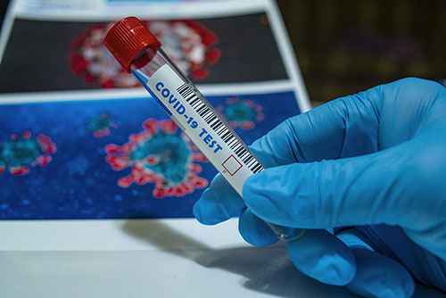 Τεστ Κορονοϊου - Διαγνωστικό μικροβιολογικό Εργαστήριο Καλαμάτα Ρουμπέα Παρασκευή