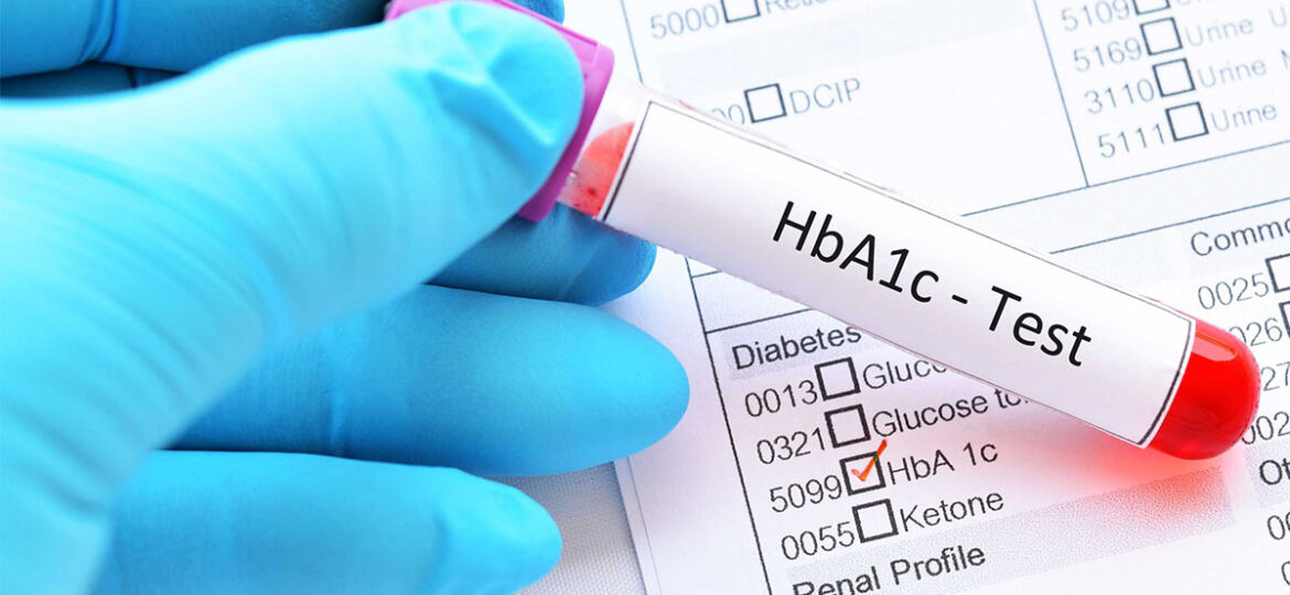 A1c test διαβητικοί ασθενείς - Μικροβιολογικό Καλαμάτα - Ρουμπέα Παρασκευή